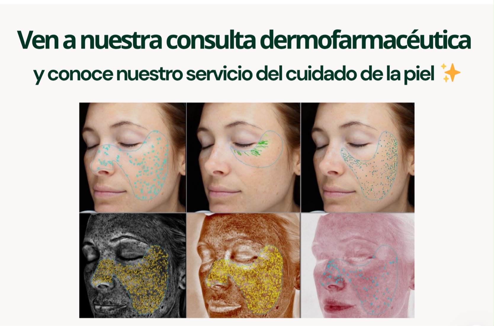Ejemplo de mapa de análisis de piel por zonas con el Dermoanalizador MDS-1000